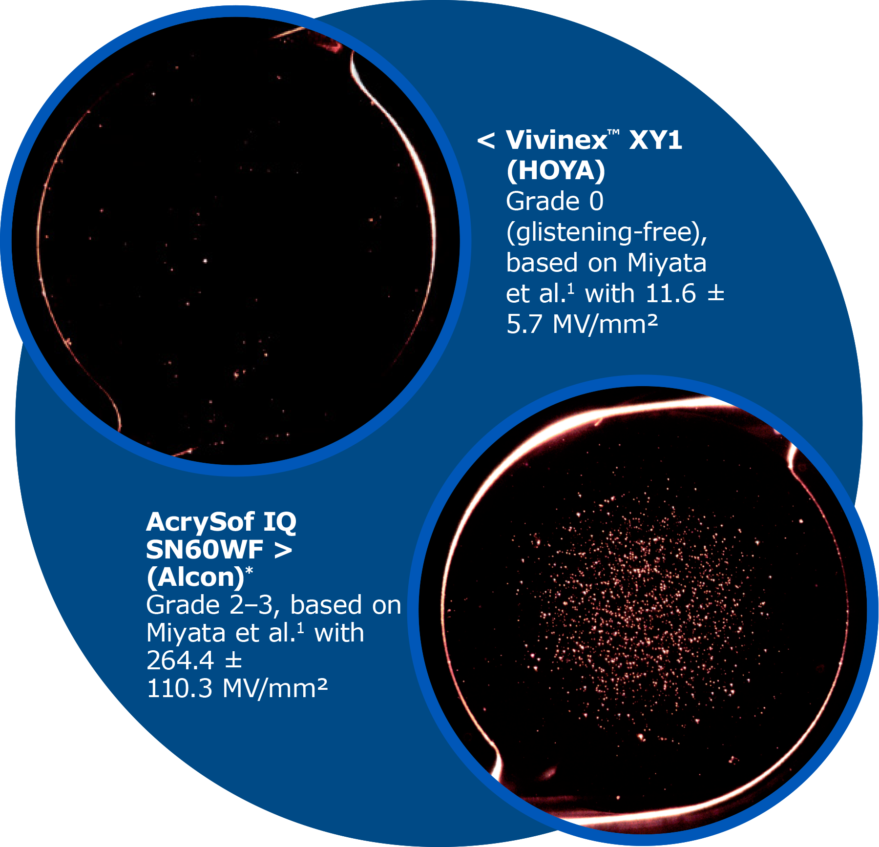 Hoya Surgical Optics Vivinex IOL